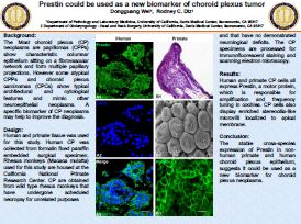 Wei Dongguang ASCP2018 poster