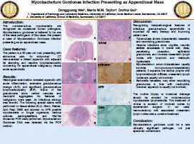 Wei Dongguang ASCP2018 poster