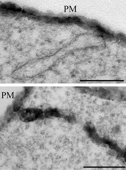 Membrane Trafficking