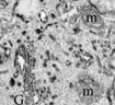 Membrane Trafficking