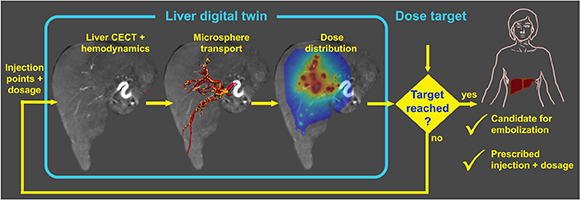 A liver digital twin for cancer treatment