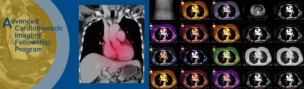 advanced cardiothoracic imaging fellowship banner