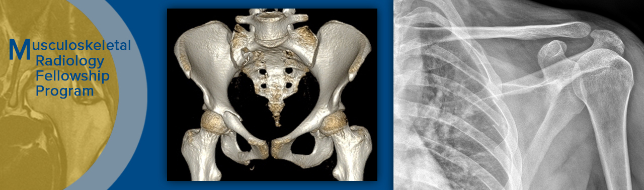 musculoskeletal radiology fellowship banner