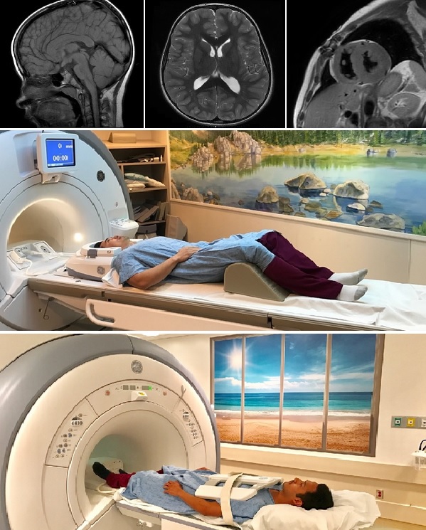 MRI