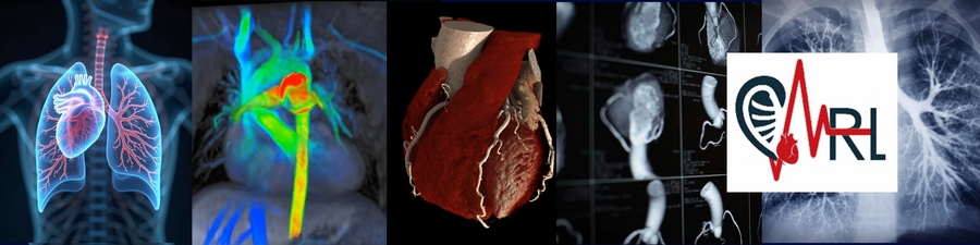 cardiothoracic scan images