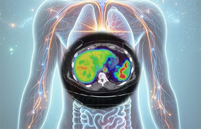 molecular liver imaging symposium art