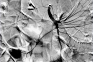  interventional radiology integrated residency