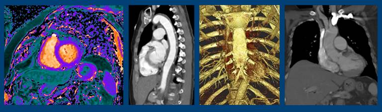 Cardiothoracic imaging banner