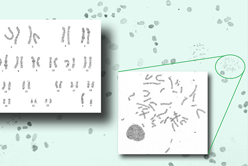 Karyotyping