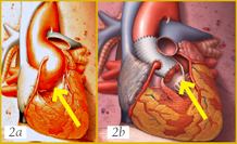 Figure 2a and 2b