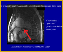 Figure 3a