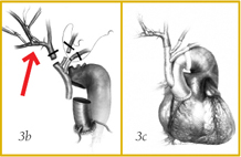 Figure 3b and 3c