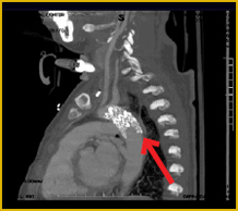 Figure 4b