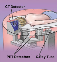 PHOTO — Clinical breast PET/CT scanner.