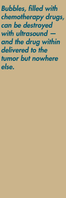 Bubbles, filled with chemotherapy drugs, can be destroyed with ultrasound — and the drug within delivered to the tumor but nowhere else.