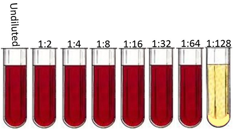 Complement Fixation Test